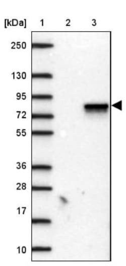 ANKRD13B Antibody, Novus Biologicals:Antibodies:Primary Antibodies